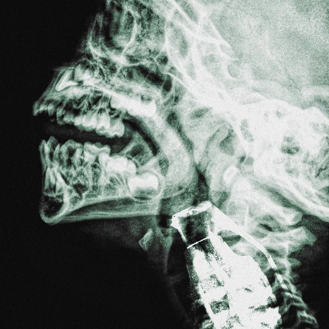 Image of Run From The Chains